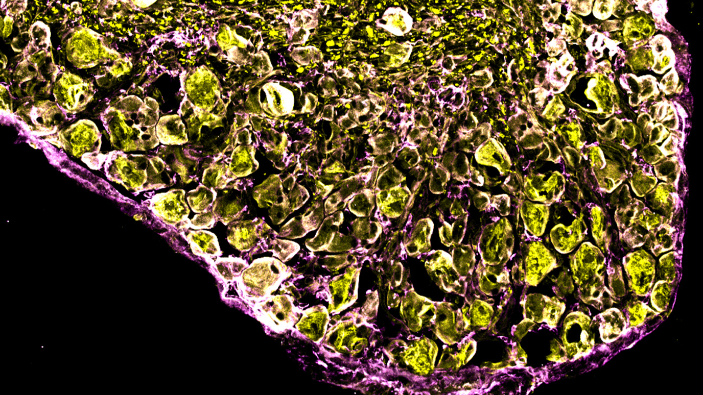 MD Anderson Research Highlights for October 2, 2024 MD Anderson Cancer Center